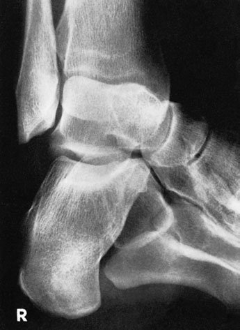 Figura 4: Aspect radiografic / Poziționare (Clark Ed. 12)