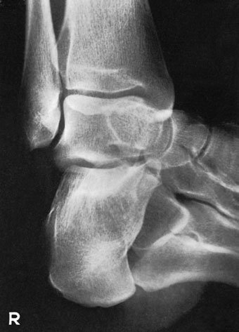 Figura 5: Aspect radiografic / Poziționare (Clark Ed. 12)