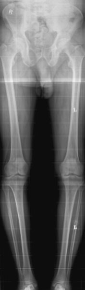Assessment prin conventional film radiologic/screen radiografie este under-