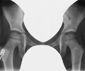 radiografie poate fie performed before sau during treatment,