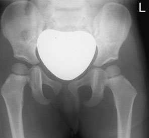 Figura 6: Aspect radiografic / Poziționare (Clark Ed. 12)
