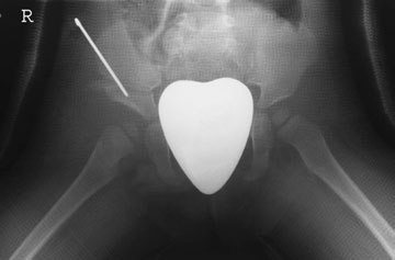 Figura 7: Aspect radiografic / Poziționare (Clark Ed. 12)