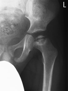 Figura 5: Aspect radiografic / Poziționare (Clark Ed. 12)