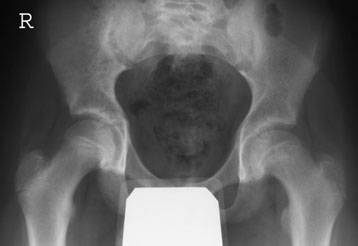 Figura 6: Aspect radiografic / Poziționare (Clark Ed. 12)