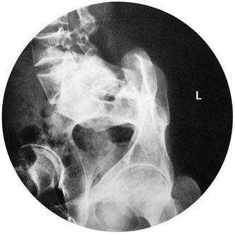 Figura 4: Aspect radiografic / Poziționare (Clark Ed. 12)