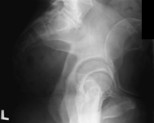 Figura 2: Aspect radiografic / Poziționare (Clark Ed. 12)