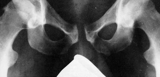 Figura 2: Aspect radiografic / Poziționare (Clark Ed. 12)
