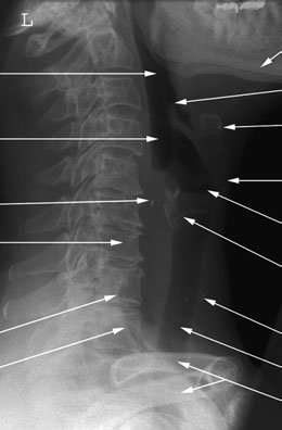 Figura 6: Aspect radiografic / Poziționare (Clark Ed. 12)