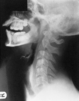 Figura 7: Aspect radiografic / Poziționare (Clark Ed. 12)