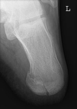 Figura 4: Aspect radiografic / Poziționare (Clark Ed. 12)