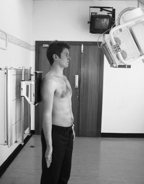 Antero-posterior (AP) radiografie de Umăr cu 25 grade caudal