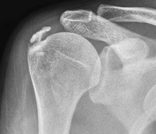 Figura 4: Aspect radiografic / Poziționare (Clark Ed. 12)