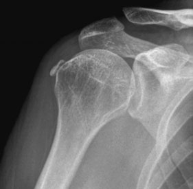 Figura 5: Aspect radiografic / Poziționare (Clark Ed. 12)