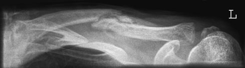 Figura 2: Aspect radiografic / Poziționare (Clark Ed. 12)