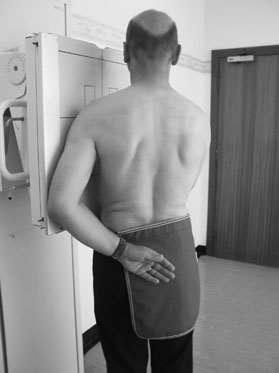 spații articulare clear de Coloană Vertebrală. Oblică incidență