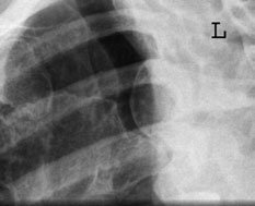 radiografie de normal drept