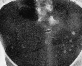 Figura 2: Aspect radiografic / Poziționare (Clark Ed. 12)