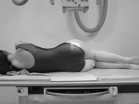 Figura 3: Aspect radiografic / Poziționare (Clark Ed. 12)
