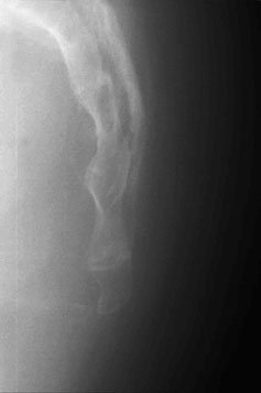 Figura 4: Aspect radiografic / Poziționare (Clark Ed. 12)