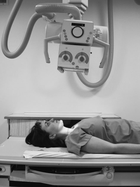 Figura 1: Aspect radiografic / Poziționare (Clark Ed. 12)