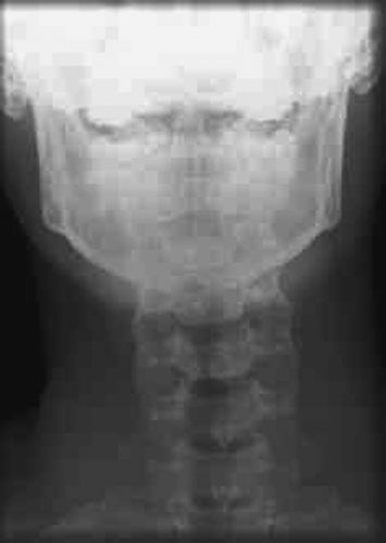 Figura 4: Aspect radiografic / Poziționare (Clark Ed. 12)