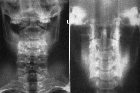 Figura 5: Aspect radiografic / Poziționare (Clark Ed. 12)