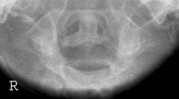 Figura 2: Aspect radiografic / Poziționare (Clark Ed. 12)
