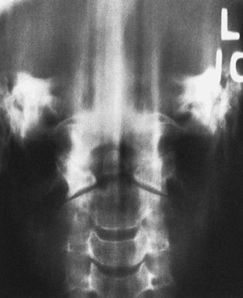 Figura 3: Aspect radiografic / Poziționare (Clark Ed. 12)