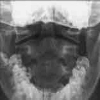 Figura 3: Aspect radiografic / Poziționare (Clark Ed. 12)
