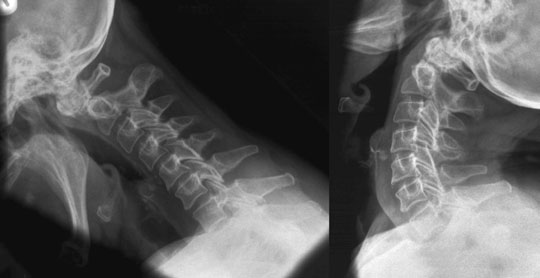 Figura 3: Aspect radiografic / Poziționare (Clark Ed. 12)