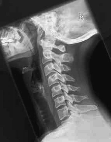 Figura 4: Aspect radiografic / Poziționare (Clark Ed. 12)
