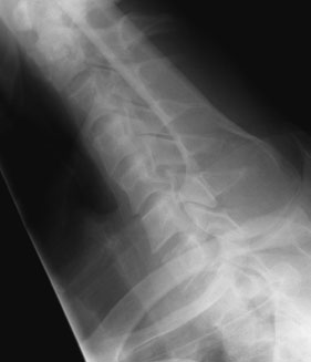Figura 5: Aspect radiografic / Poziționare (Clark Ed. 12)