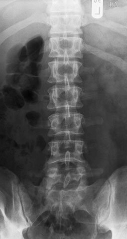 Figura 3: Aspect radiografic / Poziționare (Clark Ed. 12)