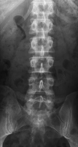 Figura 4: Aspect radiografic / Poziționare (Clark Ed. 12)