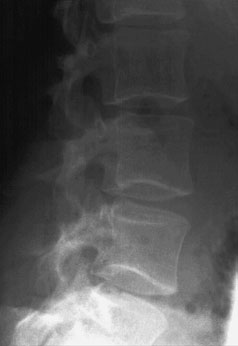 Figura 6: Aspect radiografic / Poziționare (Clark Ed. 12)