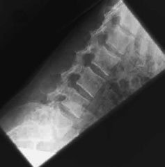 Figura 6: Aspect radiografic / Poziționare (Clark Ed. 12)