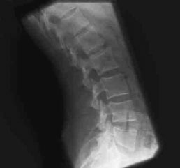 Figura 7: Aspect radiografic / Poziționare (Clark Ed. 12)