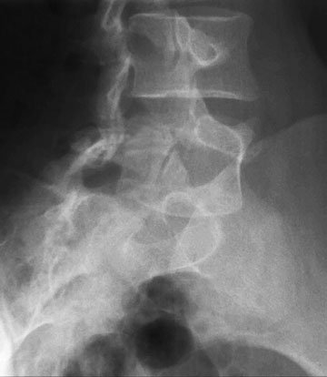 Figura 3: Aspect radiografic / Poziționare (Clark Ed. 12)