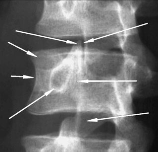 Figura 4: Aspect radiografic / Poziționare (Clark Ed. 12)