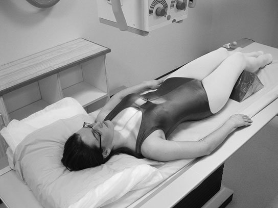 • Contrastul radiografic ridicat (vezi mai jos) determină o densitate optică ridicată la nivelul