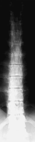 Figura 3: Aspect radiografic / Poziționare (Clark Ed. 12)