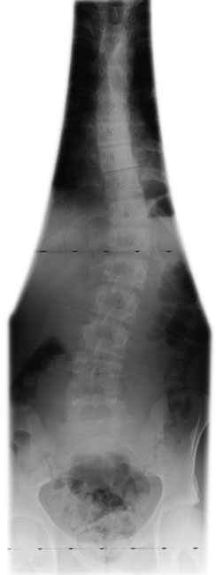 Figura 3: Aspect radiografic / Poziționare (Clark Ed. 12)