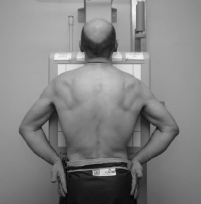 Radiografia toracică postero-anterioară (PA) ideală pentru cord și siluetă cardiovasculară și