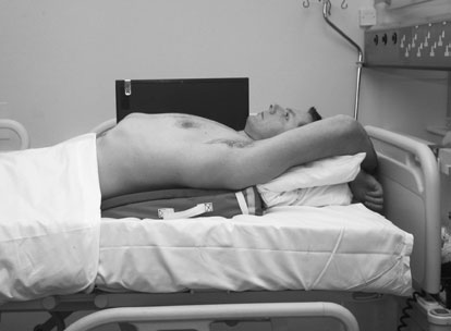 effusion cu pneumotorax