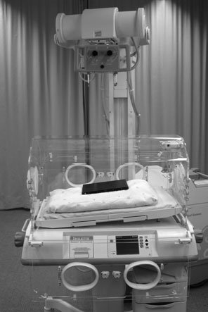 full account de neonatal radiografie este given în Section 14.