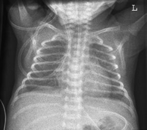 Figura 4: Aspect radiografic / Poziționare (Clark Ed. 12)