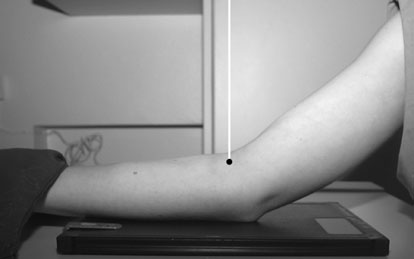 Radiografie antero-posterioară a cotului în flexie parțială