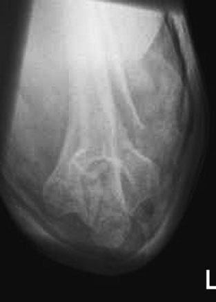 Figura 3: Aspect radiografic / Poziționare (Clark Ed. 12)