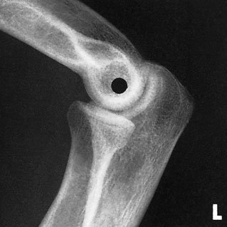 Profil (lateral) radiografie de Cot pentru cap de