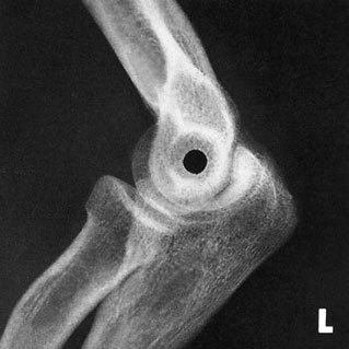 Profil (lateral) radiografie de Cot pentru cap de
